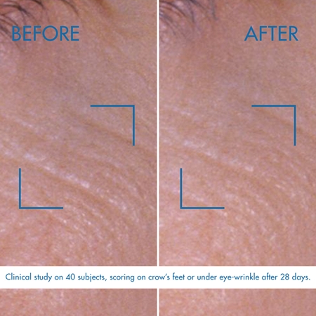 Biotherm Blue Pro-Retinol Eye Cream oční krém s retinolem