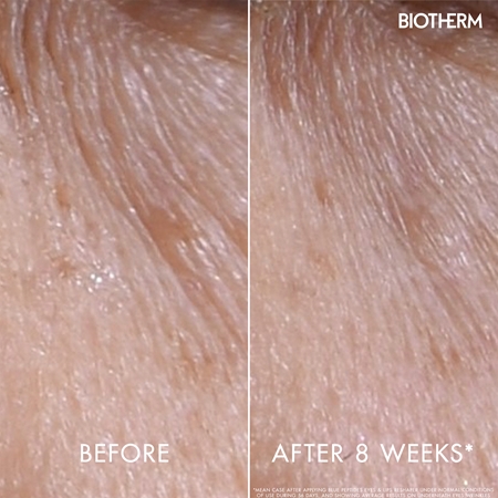 Biotherm Blue Peptides Eyes Lips Contour Reshaper soin contour yeux et lèvres