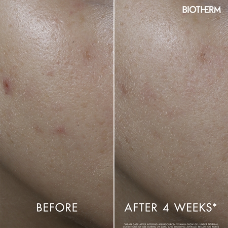 Biotherm Aquasource Vitamin Glow Gel gel viso