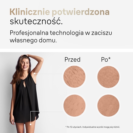 Braun Silk Expert Pro 5 PL5267 depilator IPL do ciała, twarzy, okolic bikini i pach