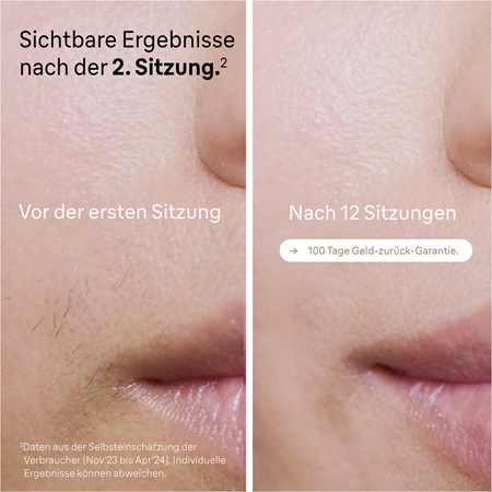 Braun Silk Expert Pro 5 PL5267 IPL Haarentferner für Körper, Gesicht, Bikini- und Achselbereich