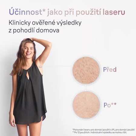 Braun Smart Skin Expert IPL7147 chytré IPL zařízení pro odstranění chloupků na tělo, tvář, oblast bikin a podpaží