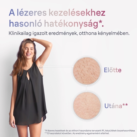 Braun Smart Skin Expert IPL7147 okos IPL készülék szőrtelenítéshez testre, arcra, bikinivonalra és hónaljra