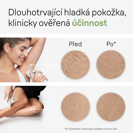 Braun Silk-expert PRO 3 IPL3020 IPL epilátor na tělo, tvář, oblast bikin a podpaží