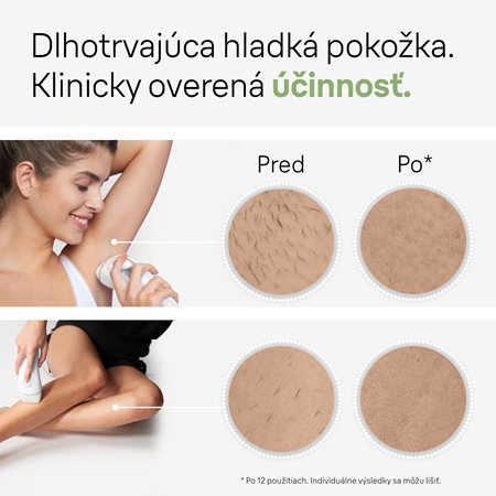 Braun Silk-expert PRO 3 IPL3020 IPL epilátor na telo, tvár, oblasť bikín a podpazušia