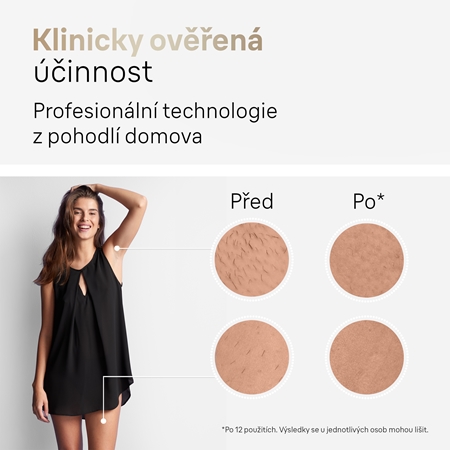 Braun Silk-expert PRO 5 IPL5052 IPL epilátor na tělo, tvář, oblast bikin a podpaží