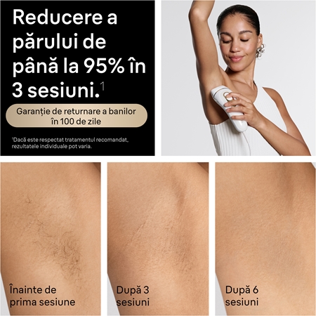 Braun IPL Silk·expert Pro 5 PL5210 dispozitiv inteligent IPL pentru îndepărtarea firelor de păr