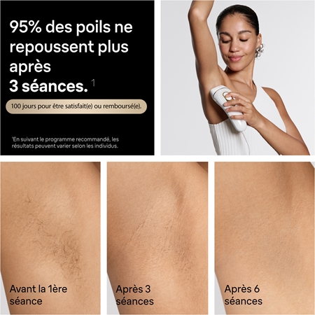 Braun IPL Silk·expert Pro 5 PL5221 dispositif intelligent pour épilation IPL pour le corps, le visage, le maillot et les aisselles