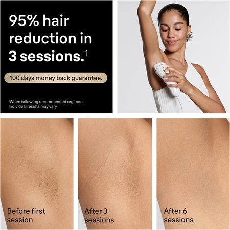 Braun IPL Silk·expert Pro 5 PL5412 smart IPL device for hair removal for the body, face, bikini area and underarms