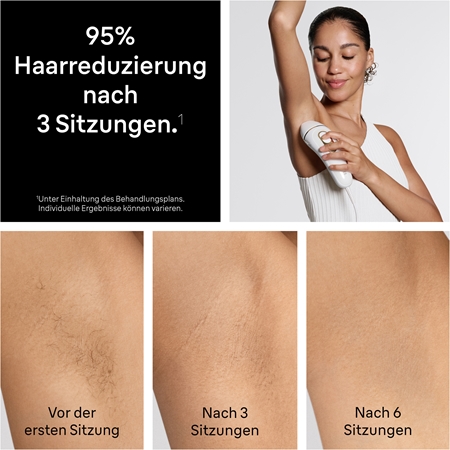 Braun IPL Silk·expert Pro 5 PL5412 intelligenter IPL-Haarentferner für Körper, Gesicht, Bikini- und Achselbereich