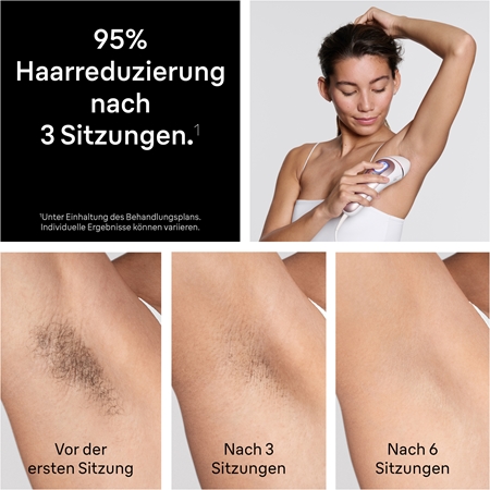 Braun Smart IPL Skin i·expert PL7321 intelligenter IPL-Haarentferner für Körper, Gesicht, Bikini- und Achselbereich