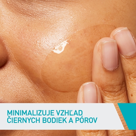 CeraVe Blemish Control Gel lokálna starostlivosť proti nedokonalostiam pleti