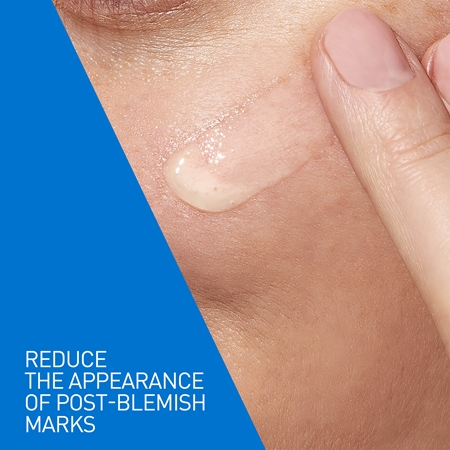CeraVe Control Cleanser & Retinol Serum Duo Σετ ενάντια στις ατέλειες της επιδερμίδας με ακμή