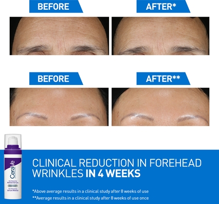 CeraVe Skin Renewing Retinol Serum Anti-Wrinkle Retinol Serum to restore the skin barrier