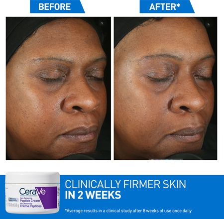 CeraVe Skin Renewing Peptide Cream Regenerating Night Cream to Restore skin density