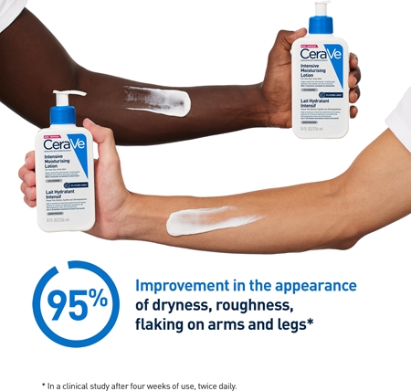 CeraVe Moisturizers Intensive Moisturizing Lotion leite hidratante para pele seca e com purido