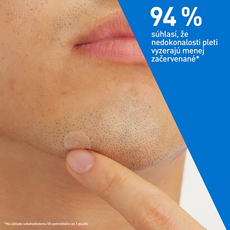 CeraVe Blemish Control Barrier Patches náplasti na problematickú pleť proti akné