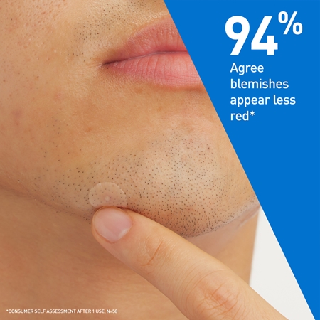 CeraVe Blemish Control Barrier Patches patchs à peaux à problèmes anti-acné