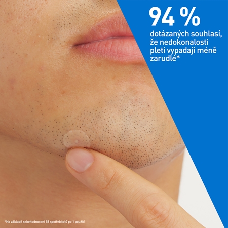 CeraVe Blemish Control Barrier Patches náplasti na problematickou pleť proti akné