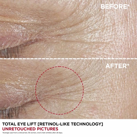 Clarins Total Eye Lift Silmakreem kortsudevastase toimega