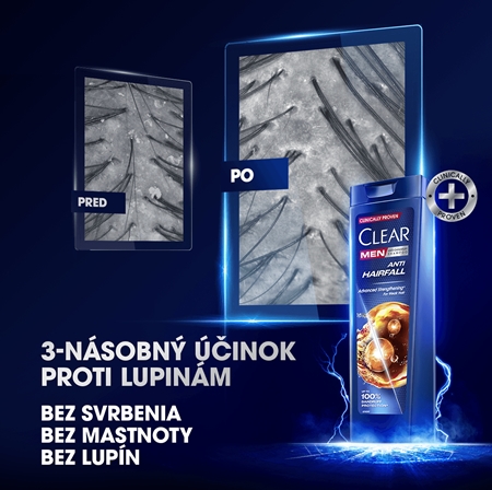 Clear Anti-Hair Fall šampón proti vypadávaniu vlasov
