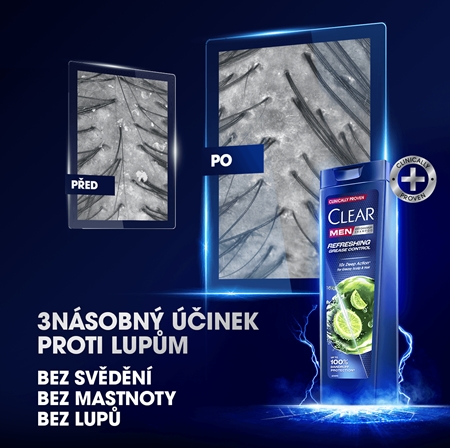 Clear Refreshing Grease šampon
