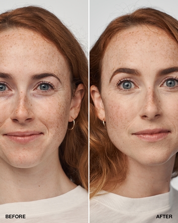 Clinique Even Better™ Clinical Serum Foundation plejende foundation SPF 20