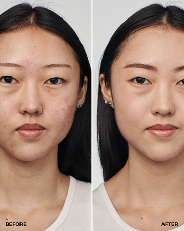 Clinique Even Better Clinical Serum Foundation SPF 20 plejende foundation SPF 20