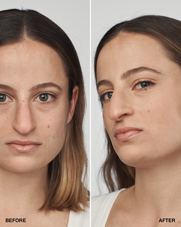 Clinique Even Better Clinical Serum Foundation SPF 20 pečující make-up SPF 20