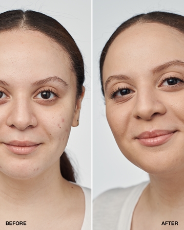 Clinique Even Better Clinical Serum Foundation SPF 20 pečující make-up SPF 20