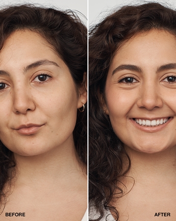 Clinique Even Better Clinical Serum Foundation SPF 20 podkład pielęgnacyjny SPF 20
