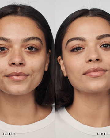 Clinique Even Better Clinical Serum Foundation SPF 20 pečující make-up SPF 20