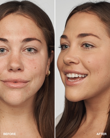 Clinique Even Better Clinical Serum Foundation SPF 20 cuidado de maquilhagem SPF 20