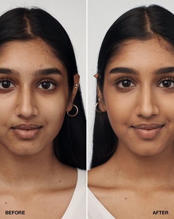 Clinique Even Better™ Clinical Serum Foundation Base Sérum SPF 20