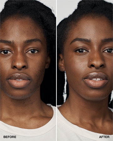 Clinique Even Better™ Clinical Serum Foundation Base Sérum SPF 20