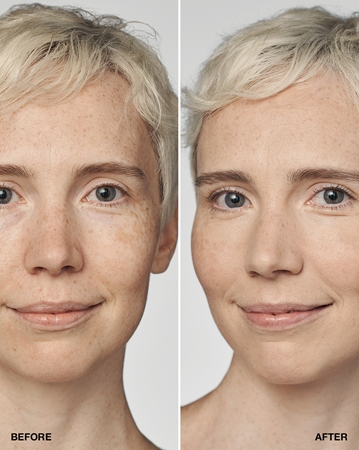 Clinique Even Better Clinical Serum Foundation SPF 20 plejende foundation SPF 20