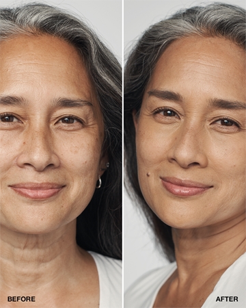 Clinique Even Better™ Clinical Serum Foundation Base Sérum SPF 20