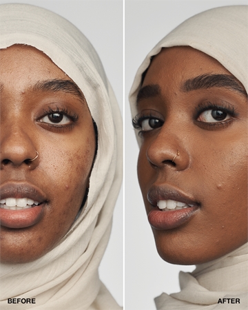 Clinique Even Better Clinical Serum Foundation SPF 20 pečující make-up SPF 20