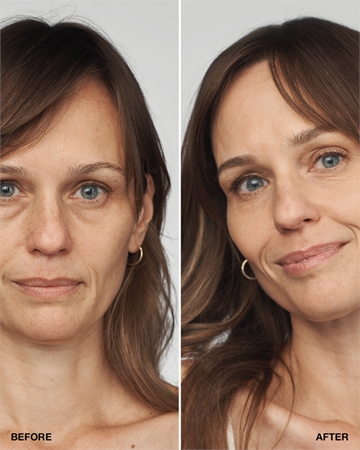 Clinique Even Better Clinical Serum Foundation SPF 20 pečující make-up SPF 20