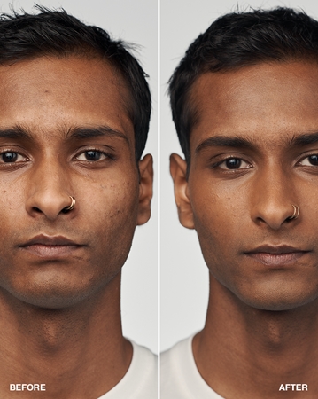 Clinique Even Better Clinical Serum Foundation SPF 20 serumo konsistencijos makiažo pagrindas SPF 20+