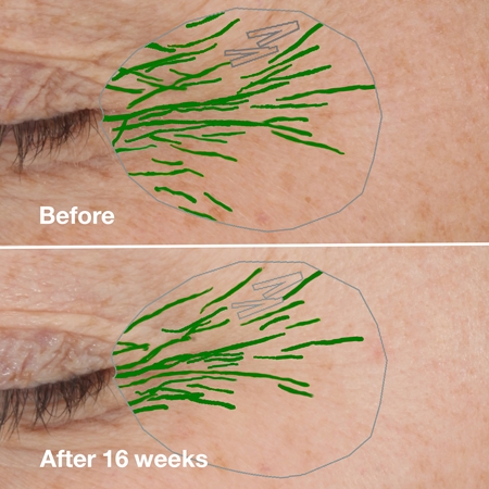 Clinique Smart Clinical™ Repair Wrinke Correcting Serum Facial Serum for the correction of wrinkles