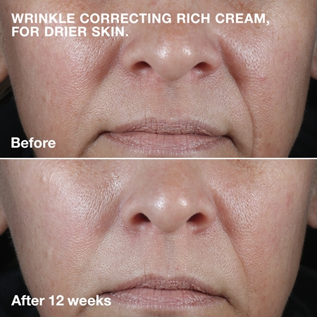 Clinique Smart Clinical™ Repair Wrinkle Correcting Cream crema nutriente antirughe