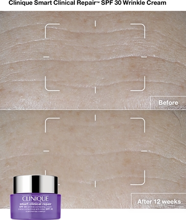 Clinique Smart Clinical™ Repair Wrinkle Correcting Cream SPF 30 crema antirughe SPF 30