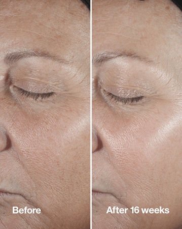 Clinique Smart Clinical™ Repair Wrinke Correcting Serum serum za obraz za korekcijo gub