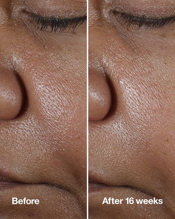 Clinique Smart Clinical™ Repair Wrinke Correcting Serum serum za obraz za korekcijo gub