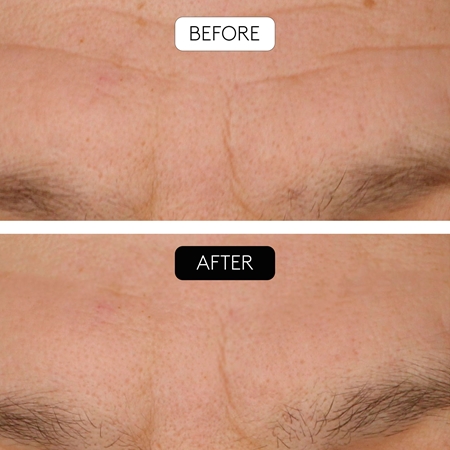Cocunat Clinical Beauty Filler set with anti-ageing effect