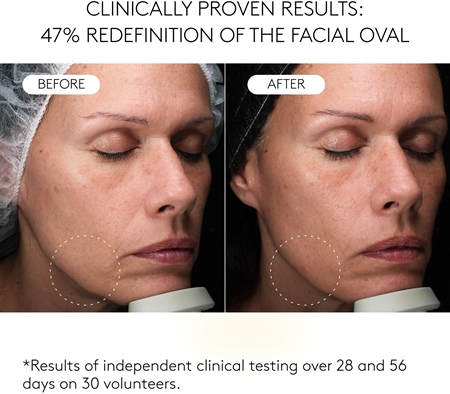 Cocunat Clinical Exosomes Lifting Serum