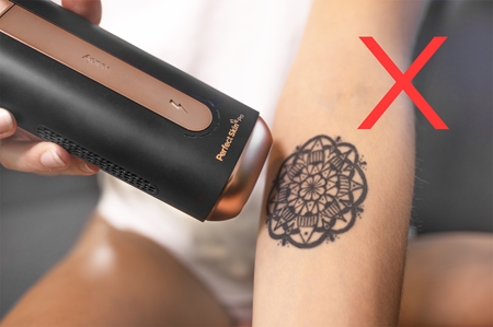 Concept Perfect Skin Pro IL5000 IPL epilator za telo, obraz, predel bikinija in pazduhe