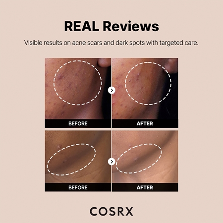 Cosrx The Alpha-Arbutin 2 Discoloration Care serum do skóry z przebarwieniami