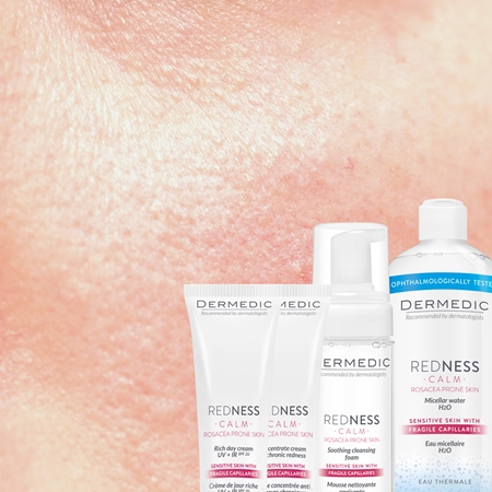 Dermedic Redness Calm крем против зачервяване и разширени капиляри SPF 20